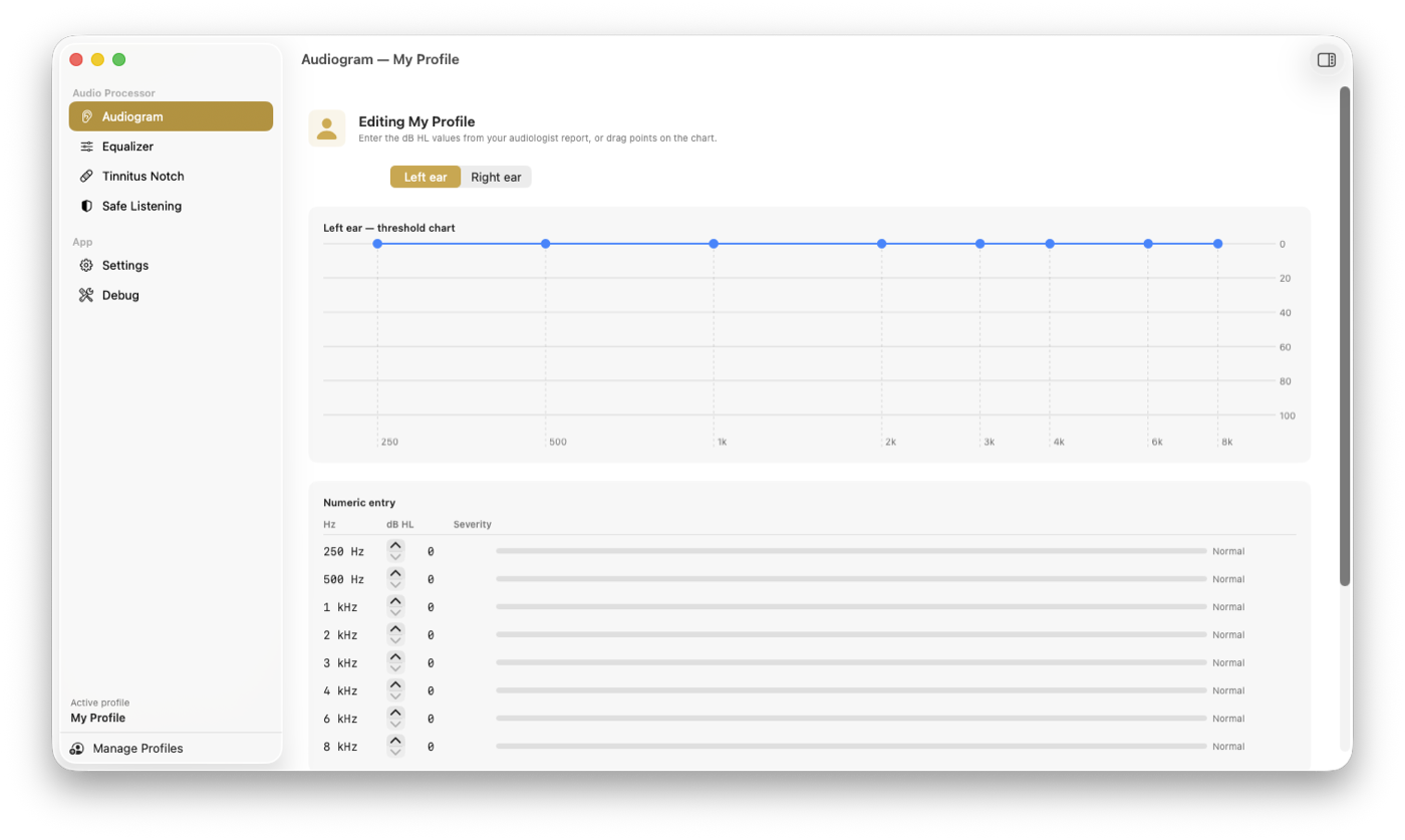 Audiogram editor — left-ear threshold chart with draggable points and a numeric entry table by frequency.